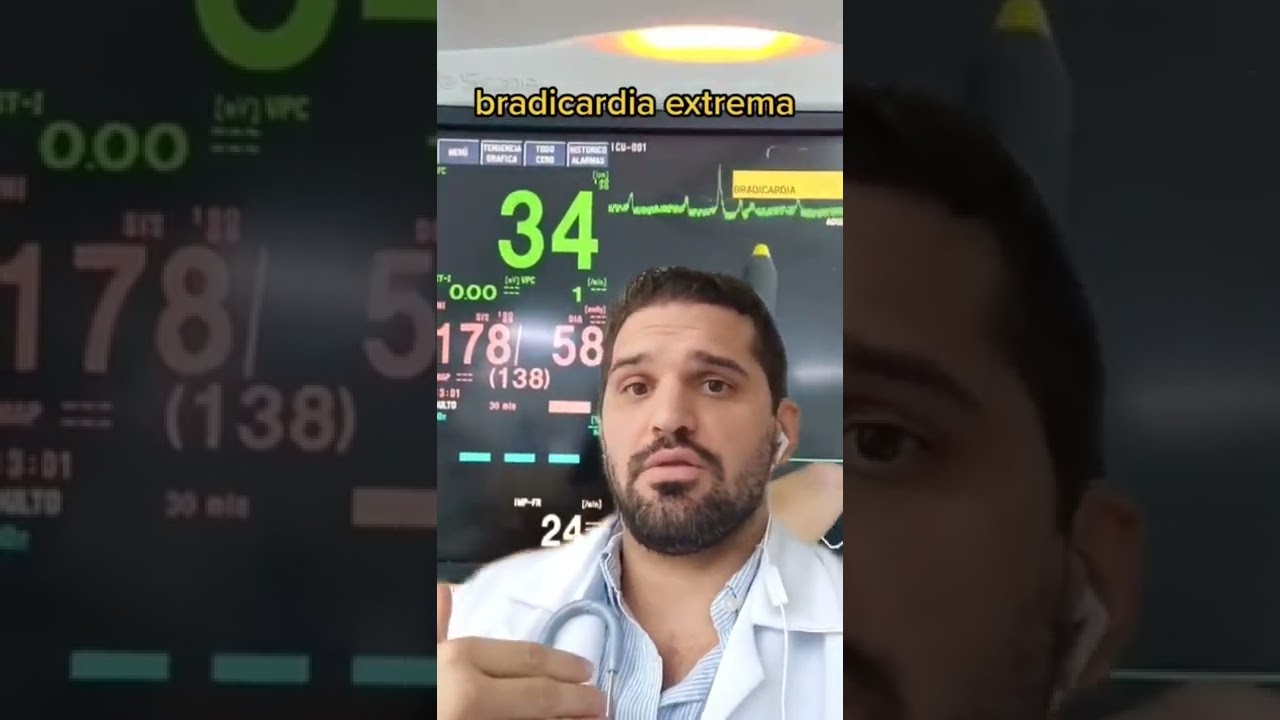 40 pulsaciones por minuto durmiendo