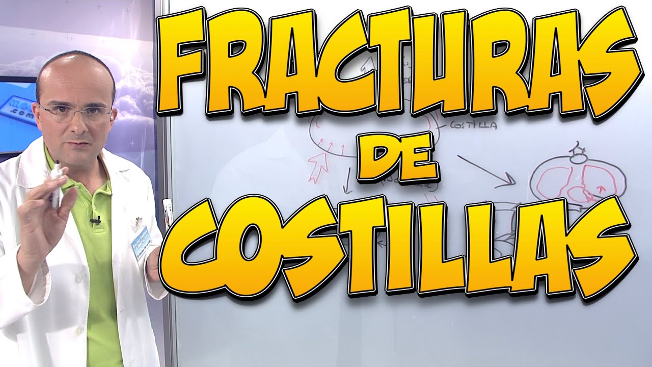 baja laboral por fractura costilla