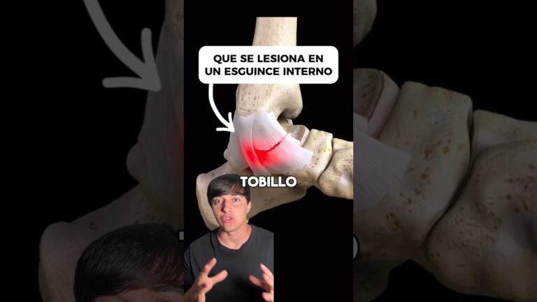 bola en el tobillo sin dolor