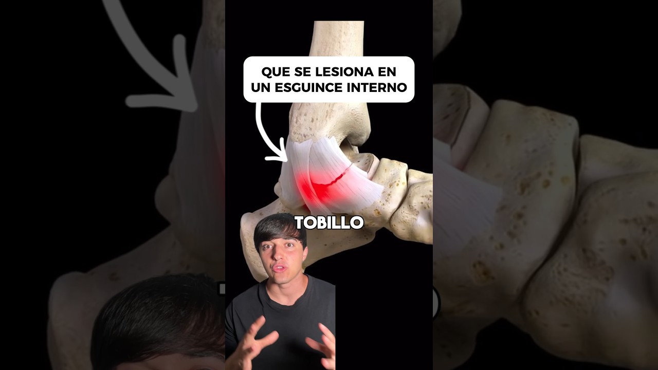 bola en el tobillo sin dolor