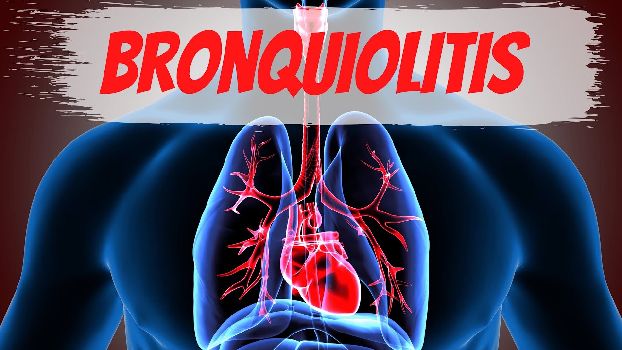 bronquiolitis en adultos es grave