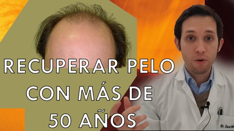caída de pelo a los 50 años hombres