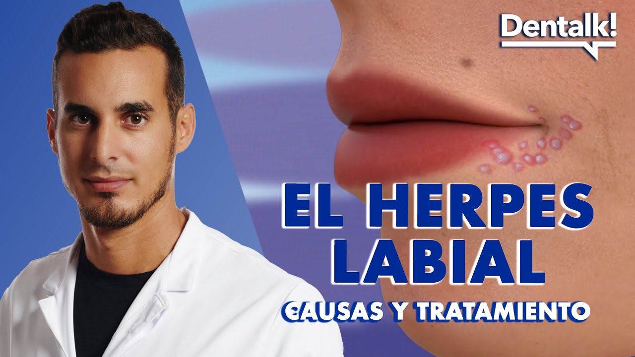 calentura en el labio causas