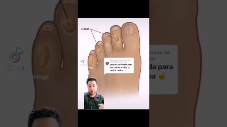 callosidades entre los dedos delos pies