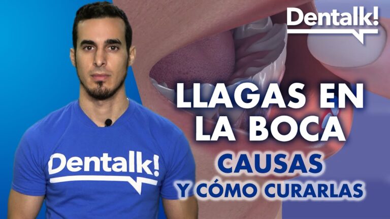 causante de llagas en la boca