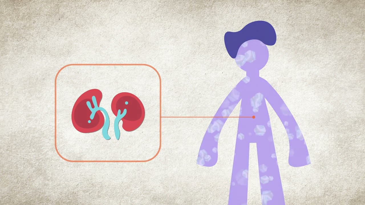 causas del potasio alto en sangre