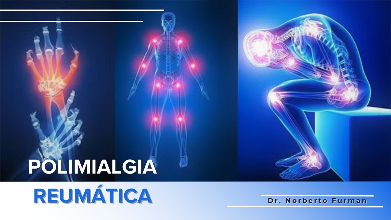 como calmar el dolor de la polimialgia reumática