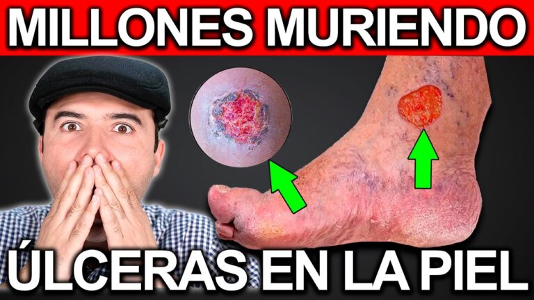 como curar llagas en los pies