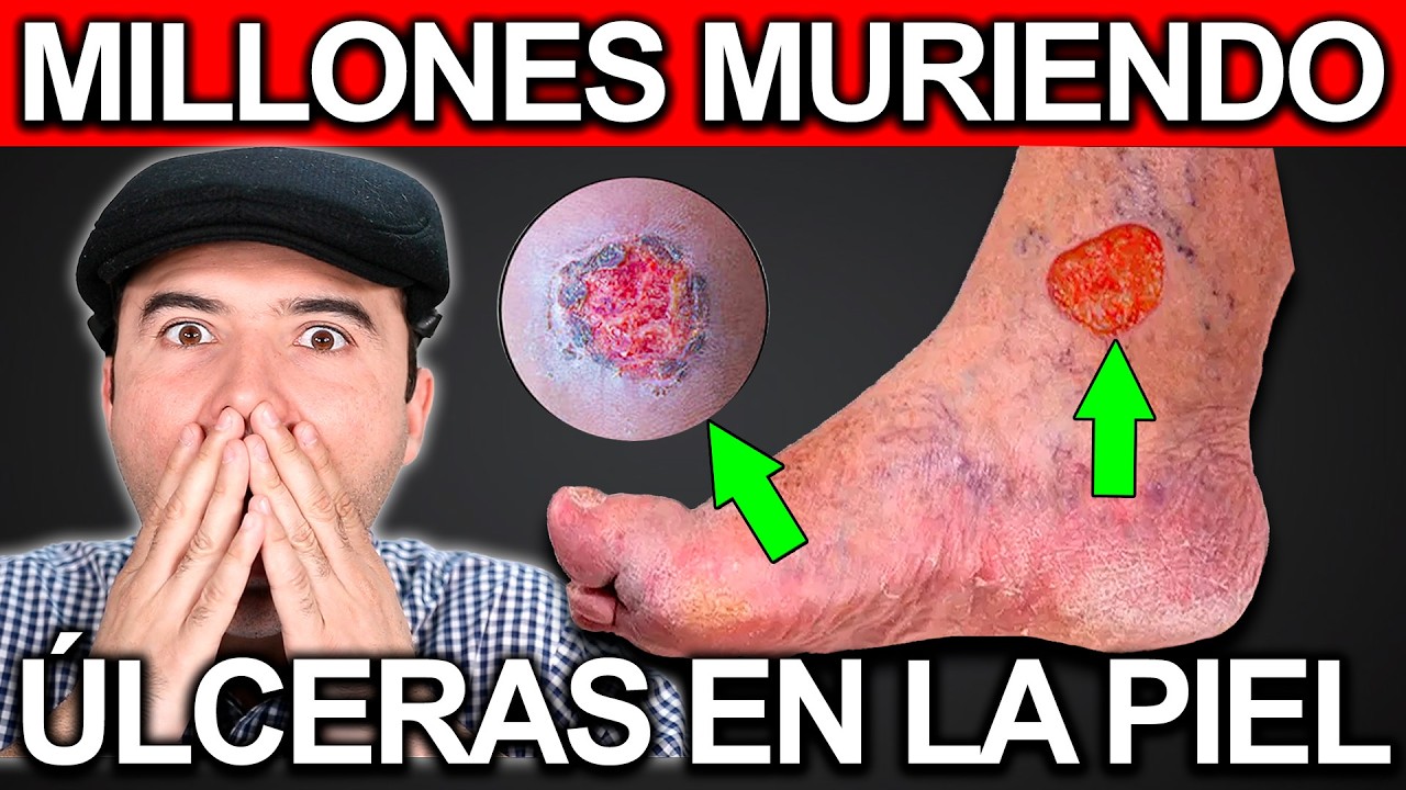como curar llagas en los pies