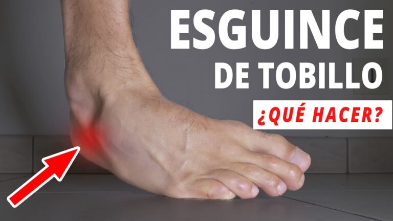cómo curar un esguince de tobillo