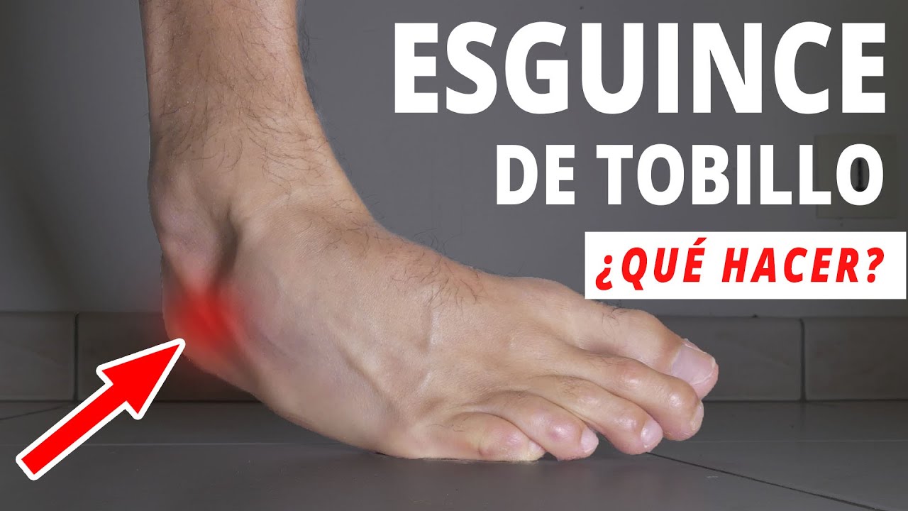 cómo curar un esguince de tobillo