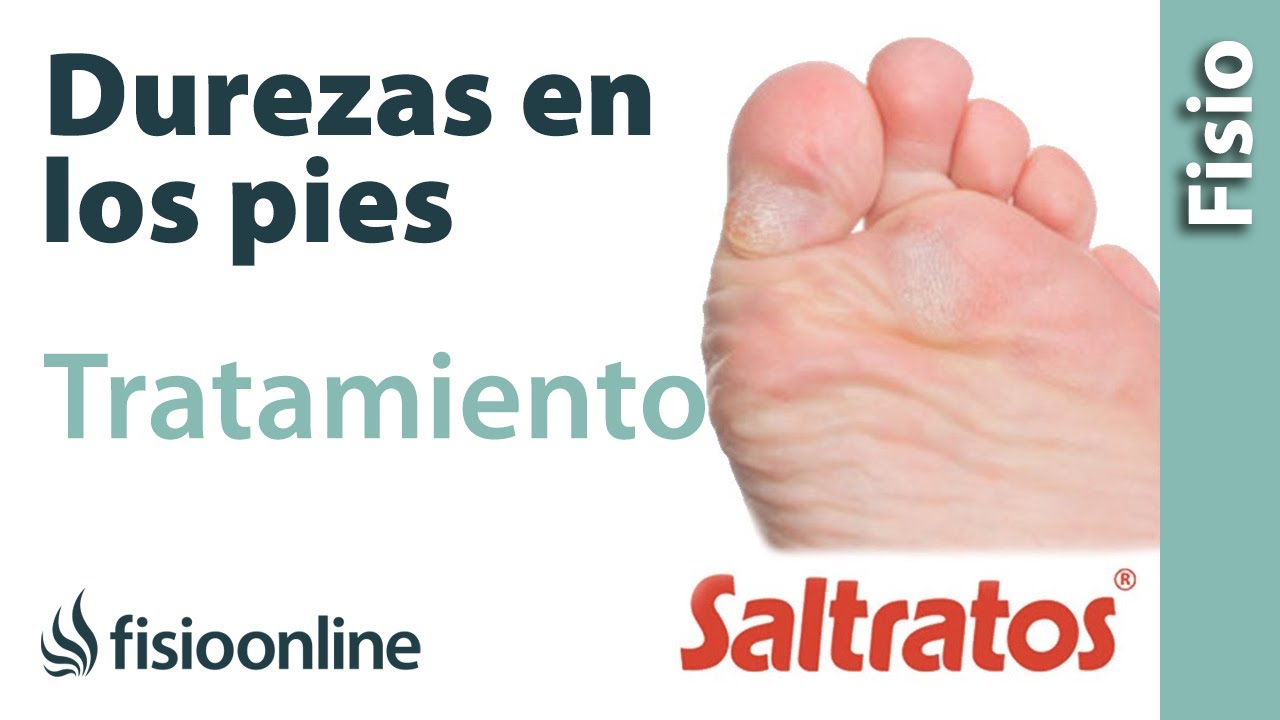 como eliminar callosidades en los pies