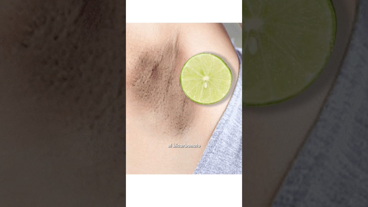 como no sudar por las axilas