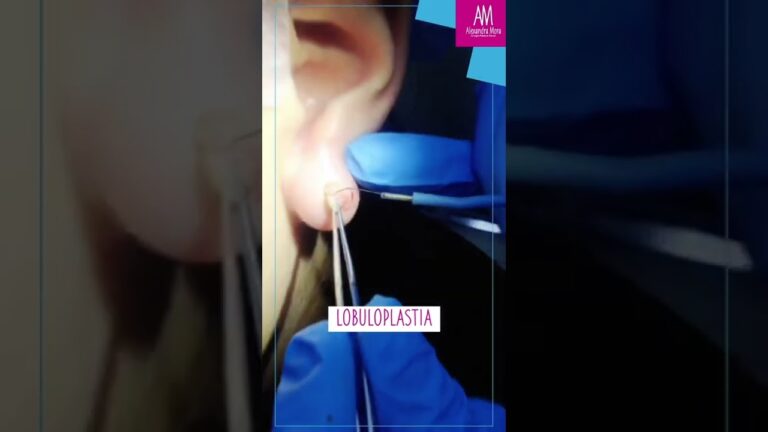 como quitar bulto en el lobulo de la oreja