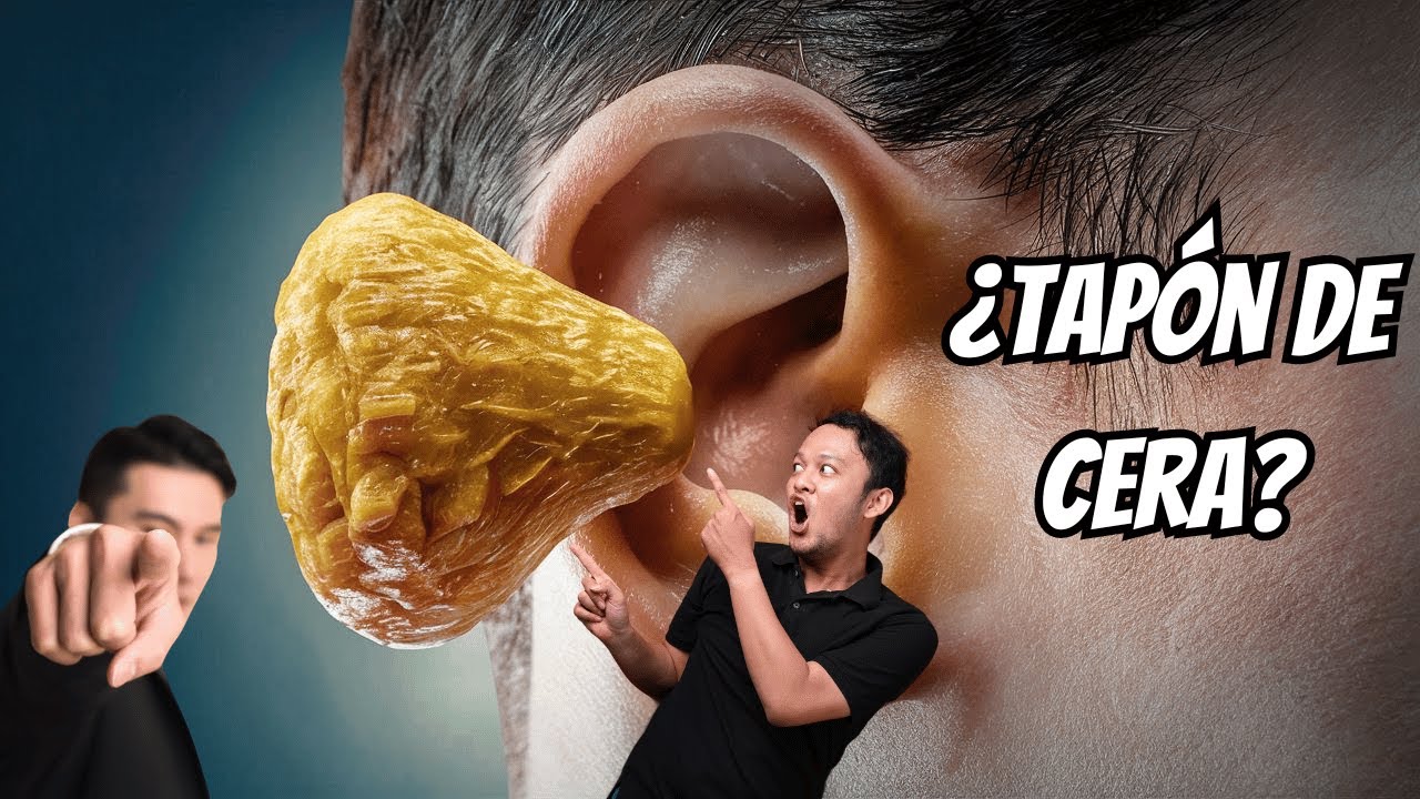 como quitarse un tapon de cera del oido
