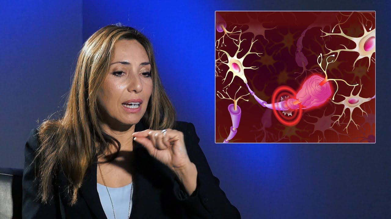 como se detecta la esclerosis multiple