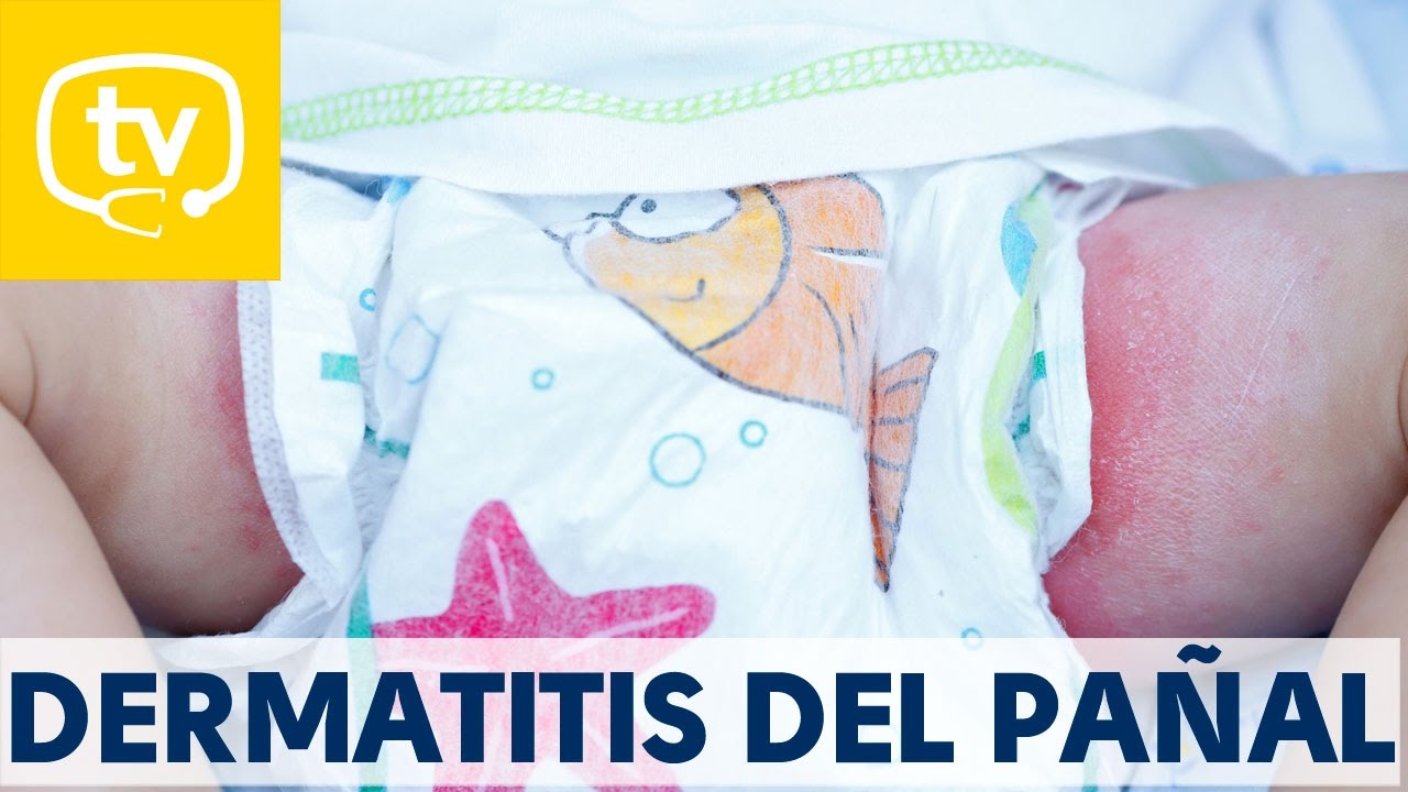 crema para culete irritado adulto