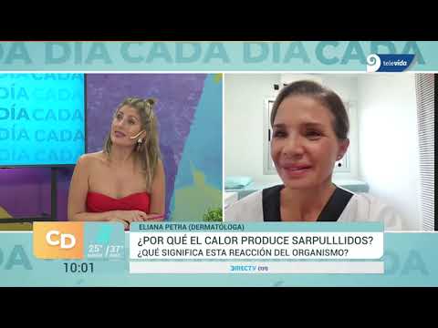 crema para sarpullido por calor