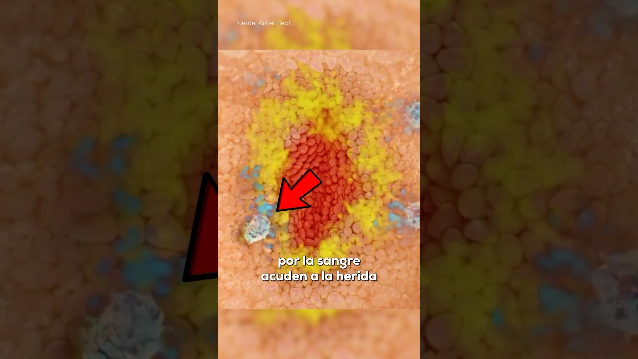 cuanto tarda en cicatrizar una herida en carne viva