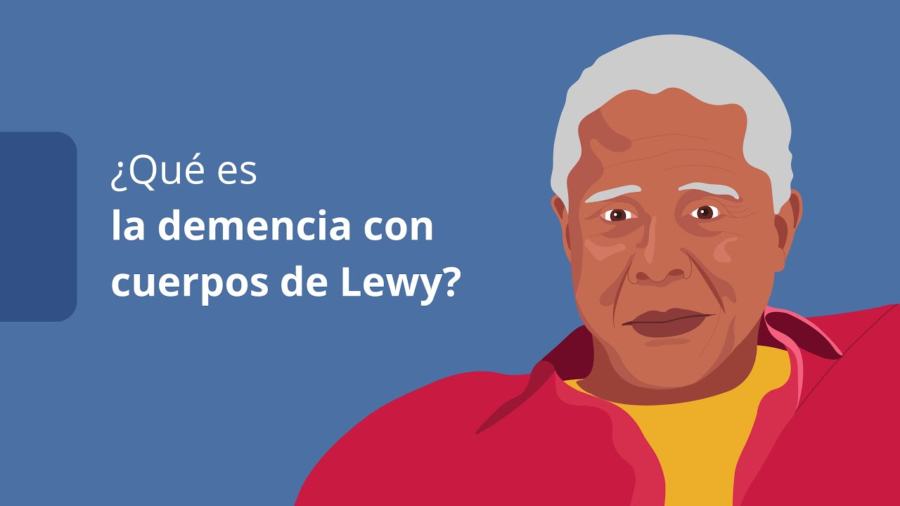 demencia cuerpos de lewy fases