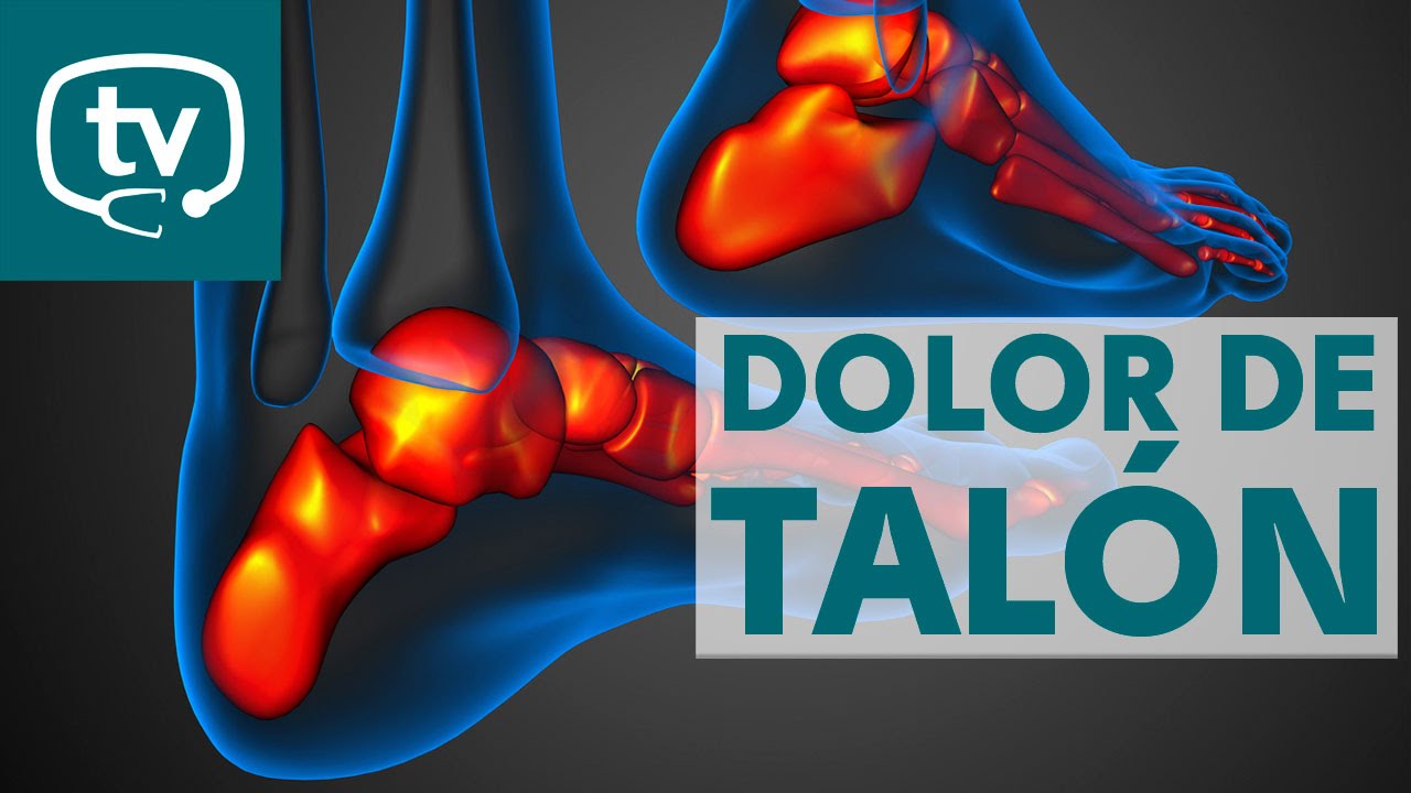 dolor en el talon causas