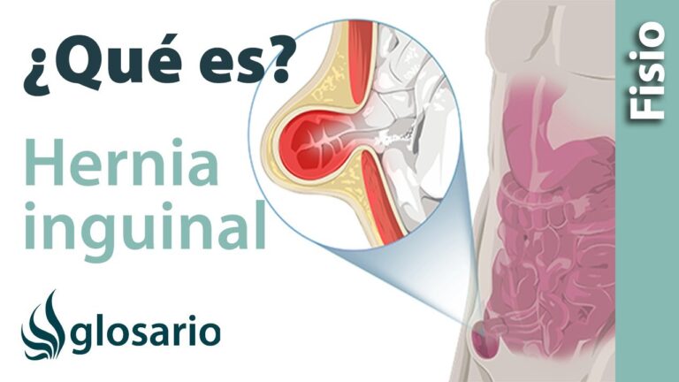 donde duele la hernia inguinal