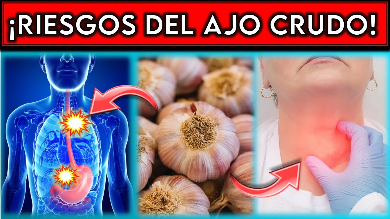 el ajo irrita la vejiga