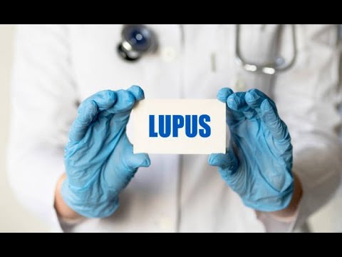 el lupus se puede contagiar