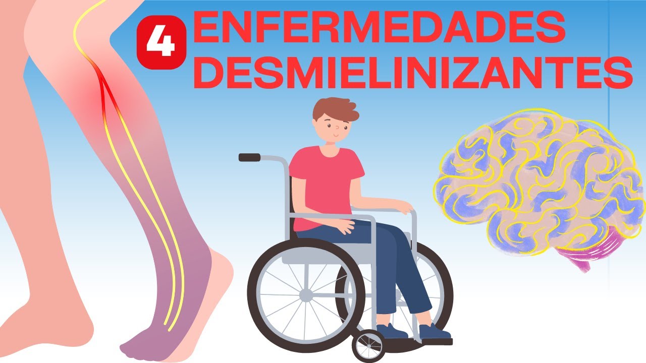 enfermedades desmielinizantes esperanza de vida