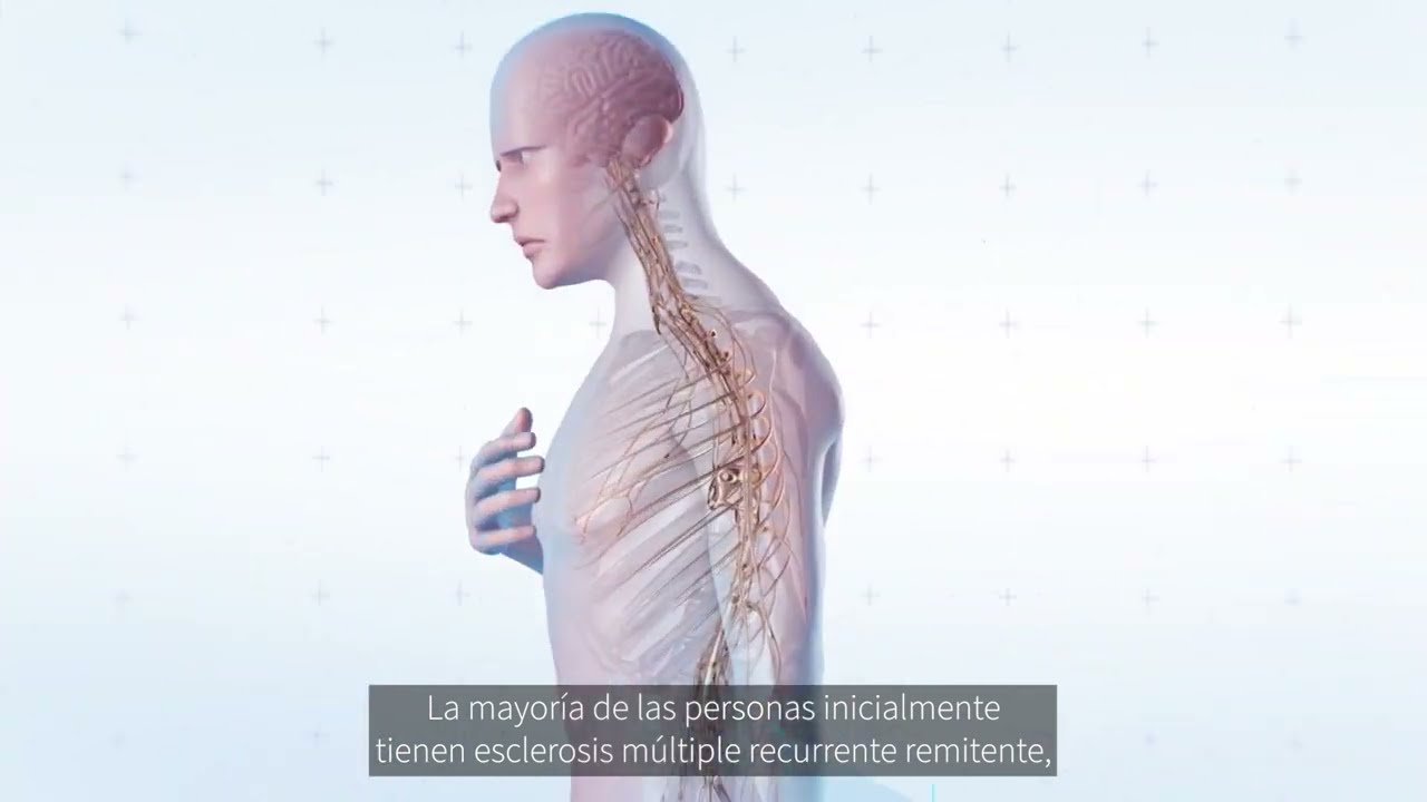 es bueno andar con esclerosis múltiple