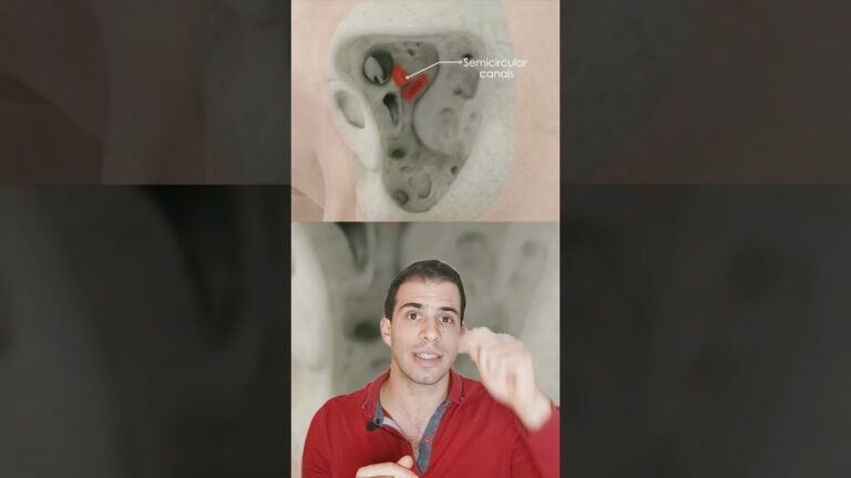 es complicada la operación de colesteatoma