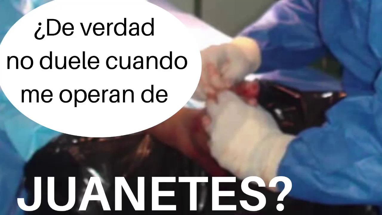 es dolorosa la operación de juanetes
