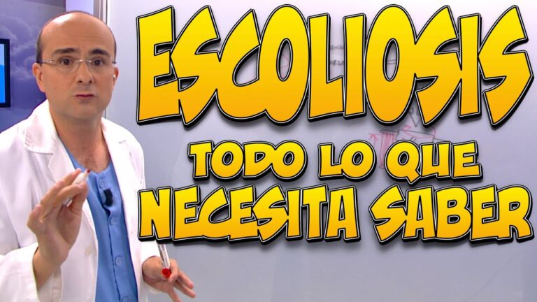 escoliosis en adultos de 50 años