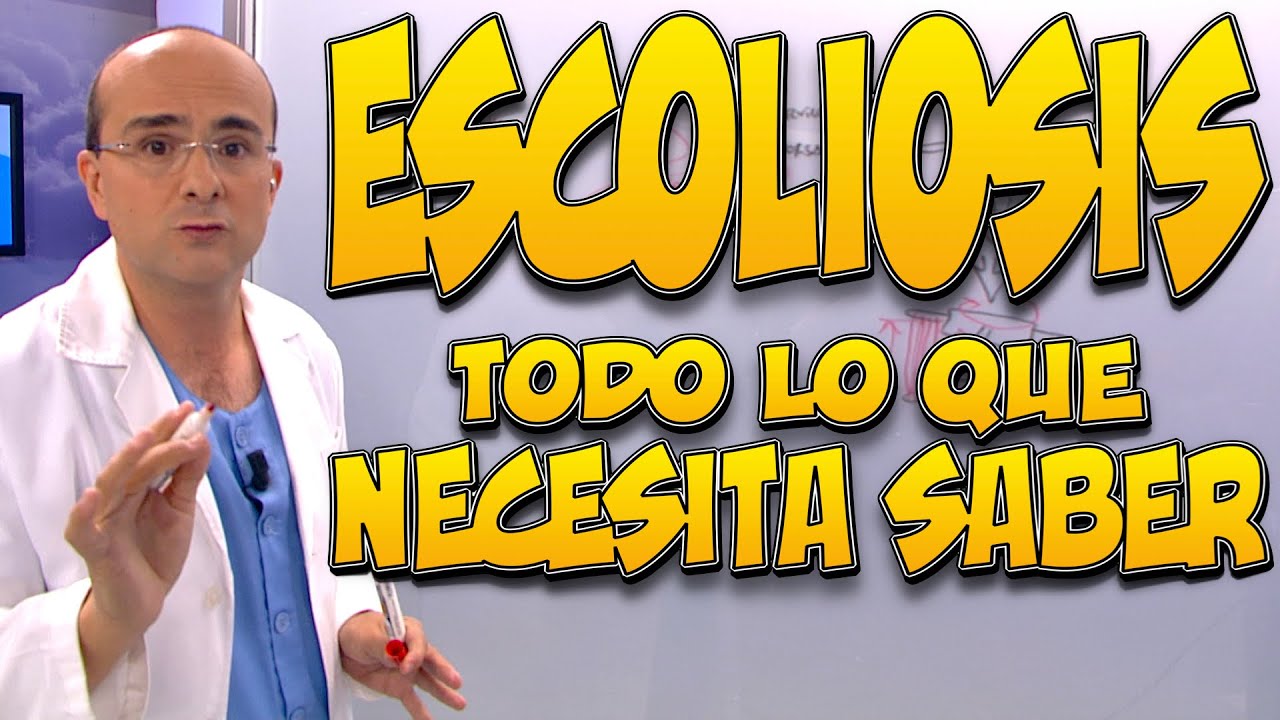 escoliosis en adultos de 50 años