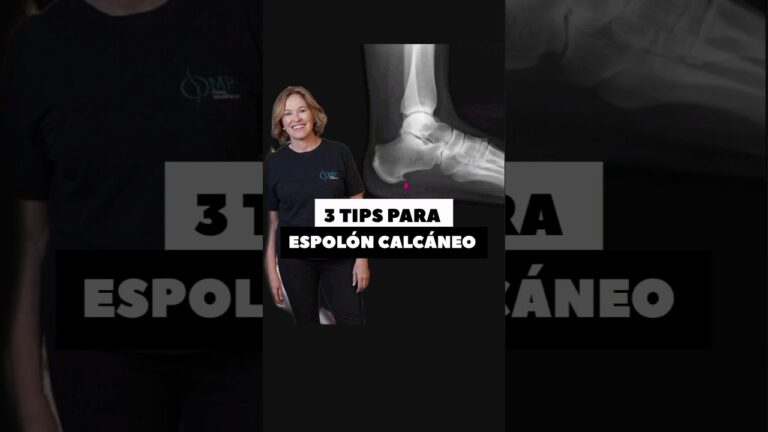 espolon en talon del pie