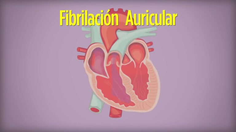 fibrilacion auricular esperanza de vida