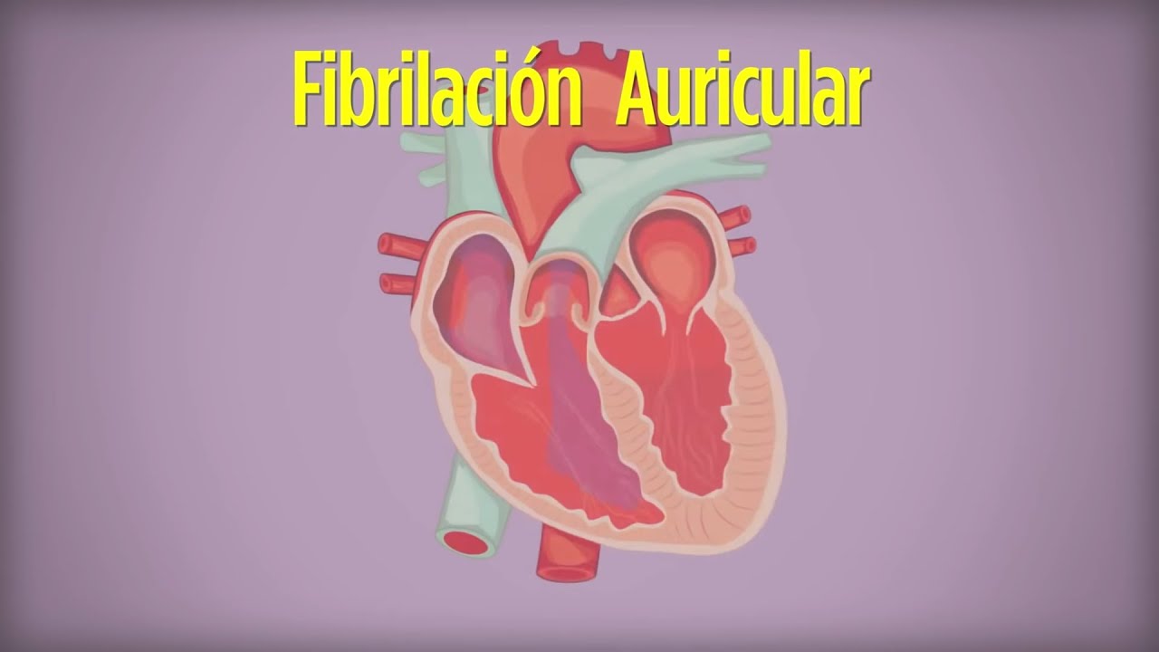 fibrilacion auricular esperanza de vida