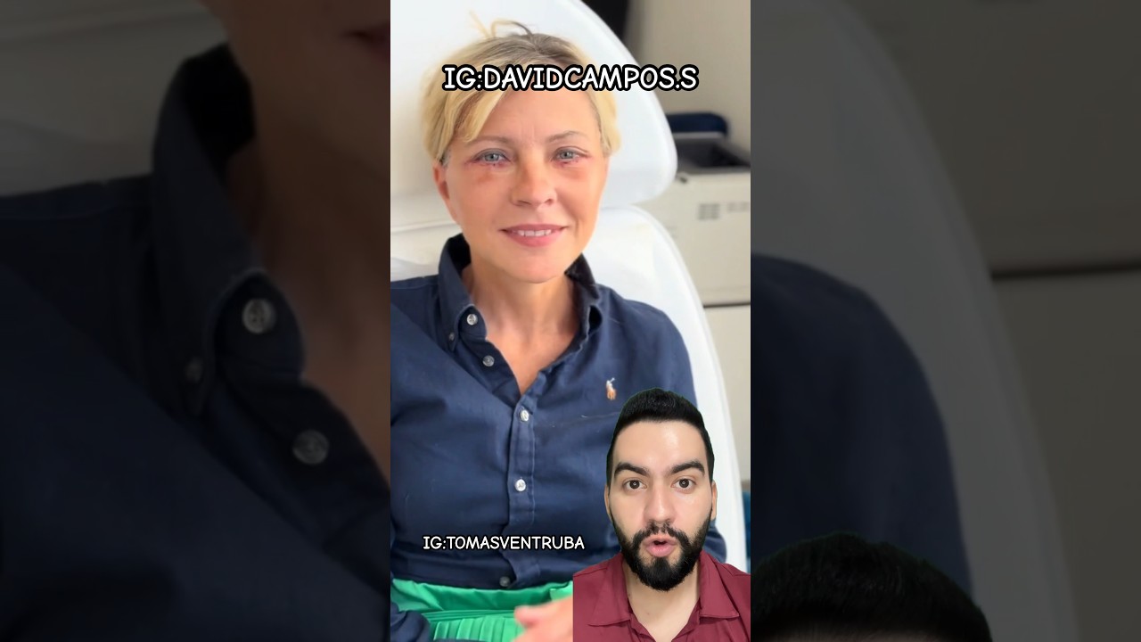 flacidez facial a los 60