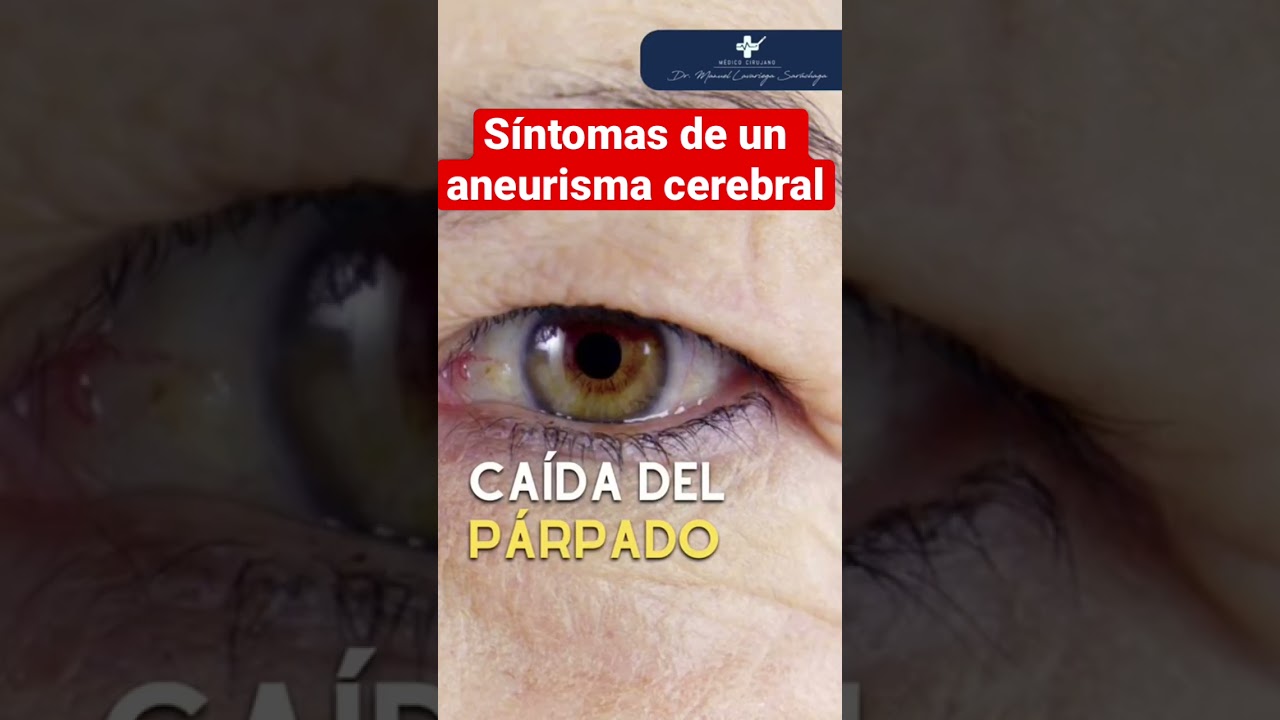 grado de discapacidad por aneurisma cerebral