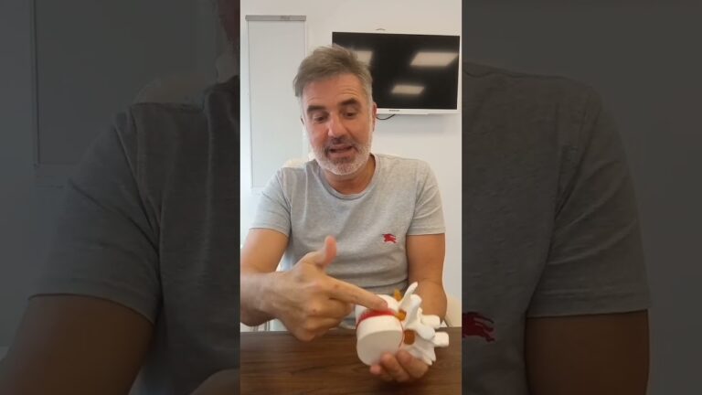 grado de discapacidad por discopatía degenerativa lumbar