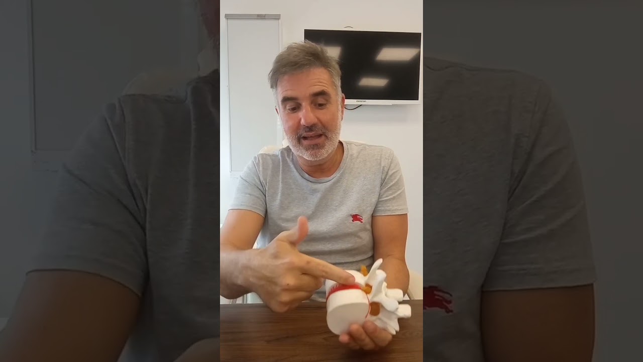 grado de discapacidad por discopatía degenerativa lumbar