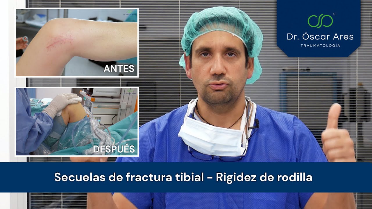 grado discapacidad rotura meseta tibial