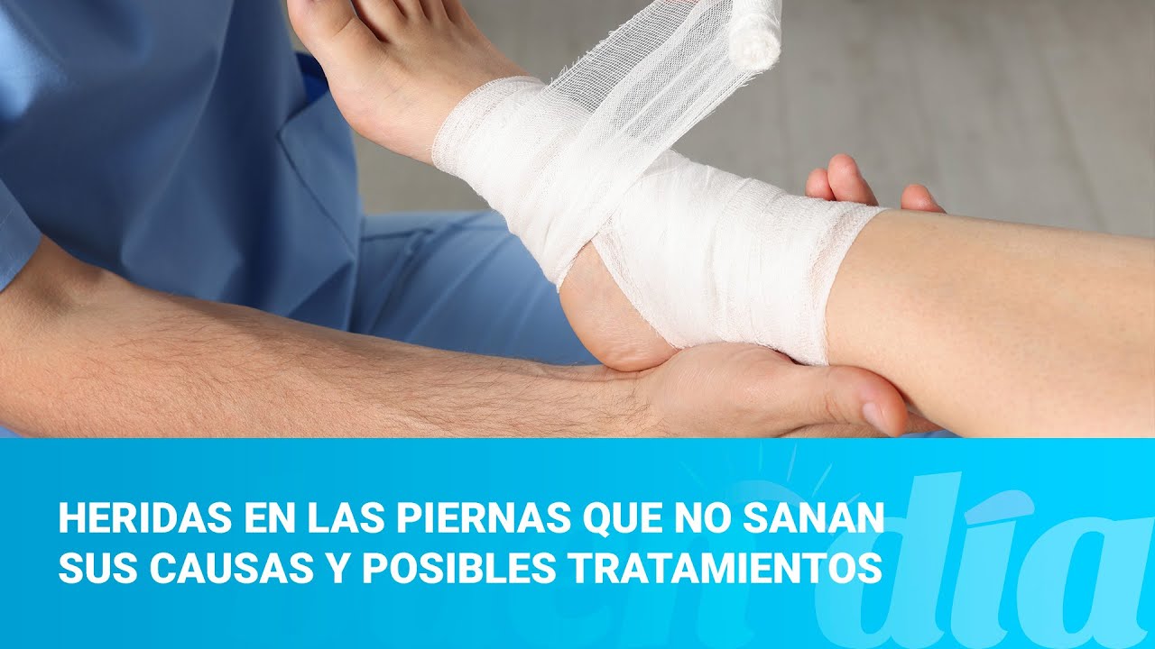 heridas en las piernas que no curan