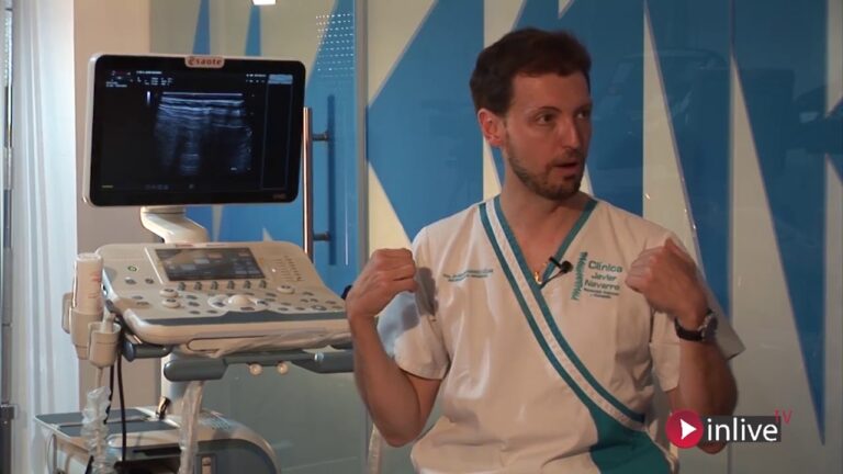 hernia de hiato dolor espalda