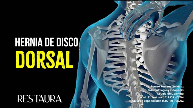 hernia discal dorsal d7 d8 síntomas