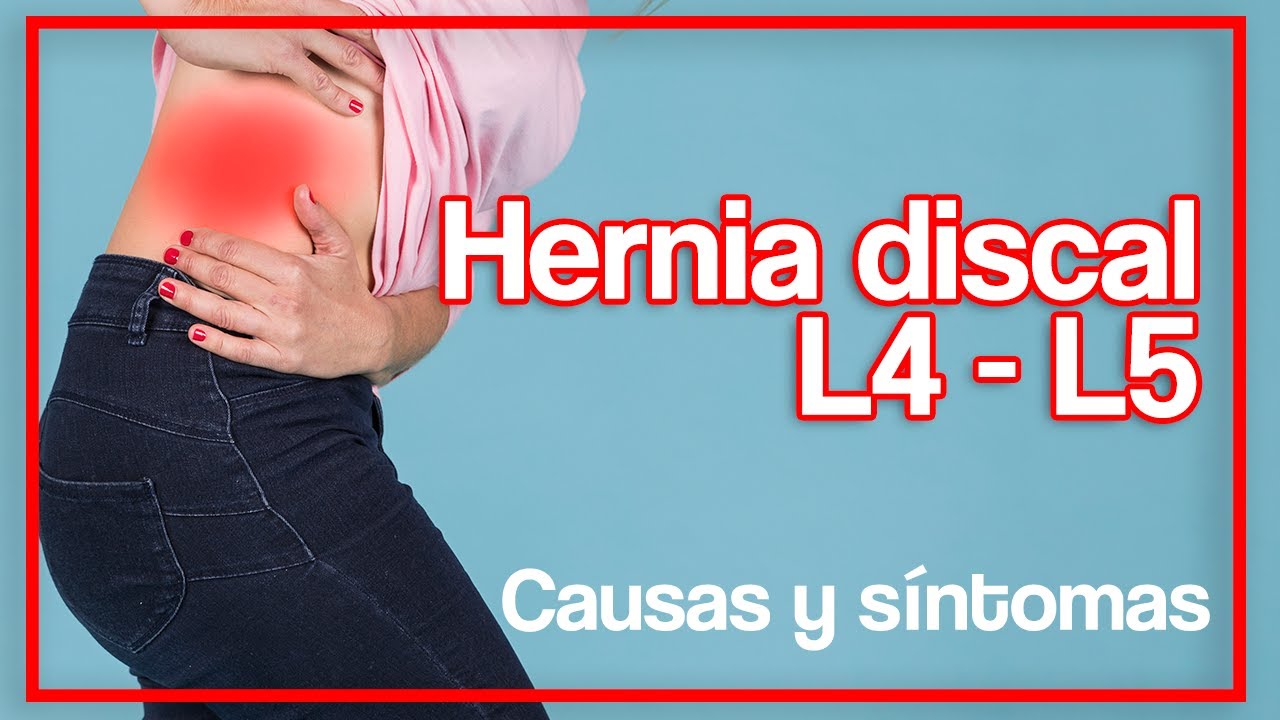 hernia discal l4 l5 sintomas