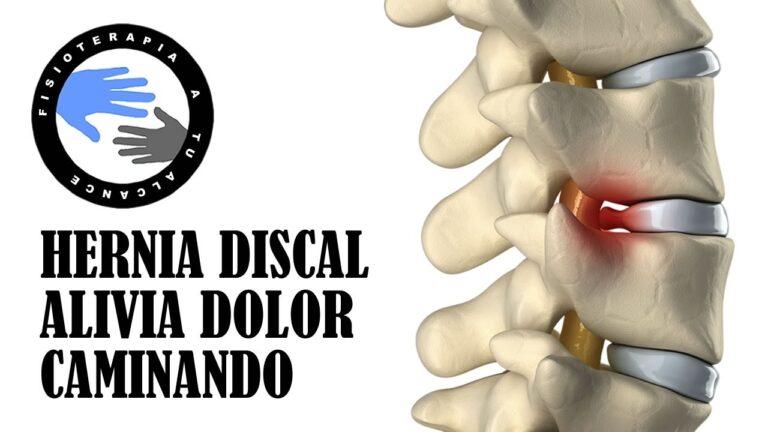hernia discal no puedo caminar