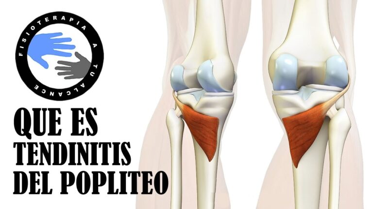inflamacion detras de la rodilla