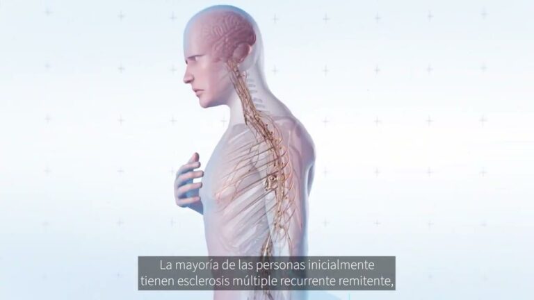 la esclerosis múltiple es degenerativa