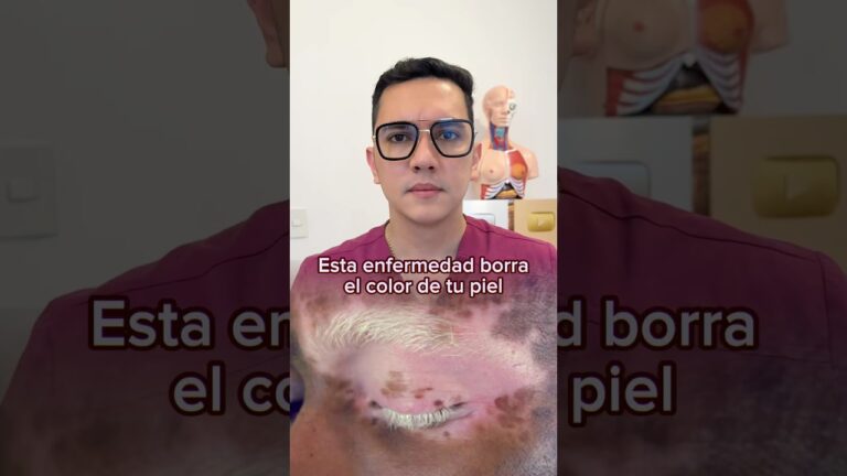 manchas en la piel por fibromialgia